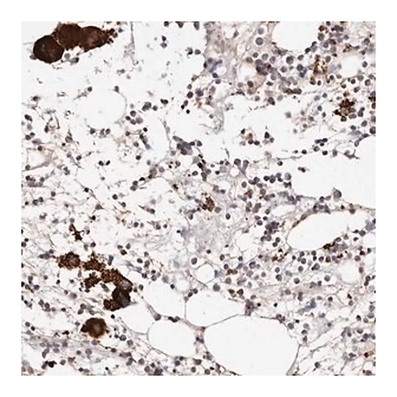 Merck Anti-PTPN22 antibody produced in rabbit