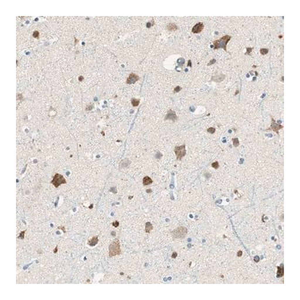 Merck Anti-RORB antibody produced in rabbit