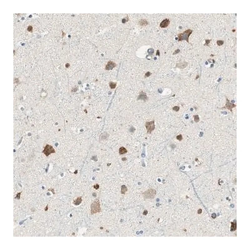 Merck Anti-RORB antibody produced in rabbit