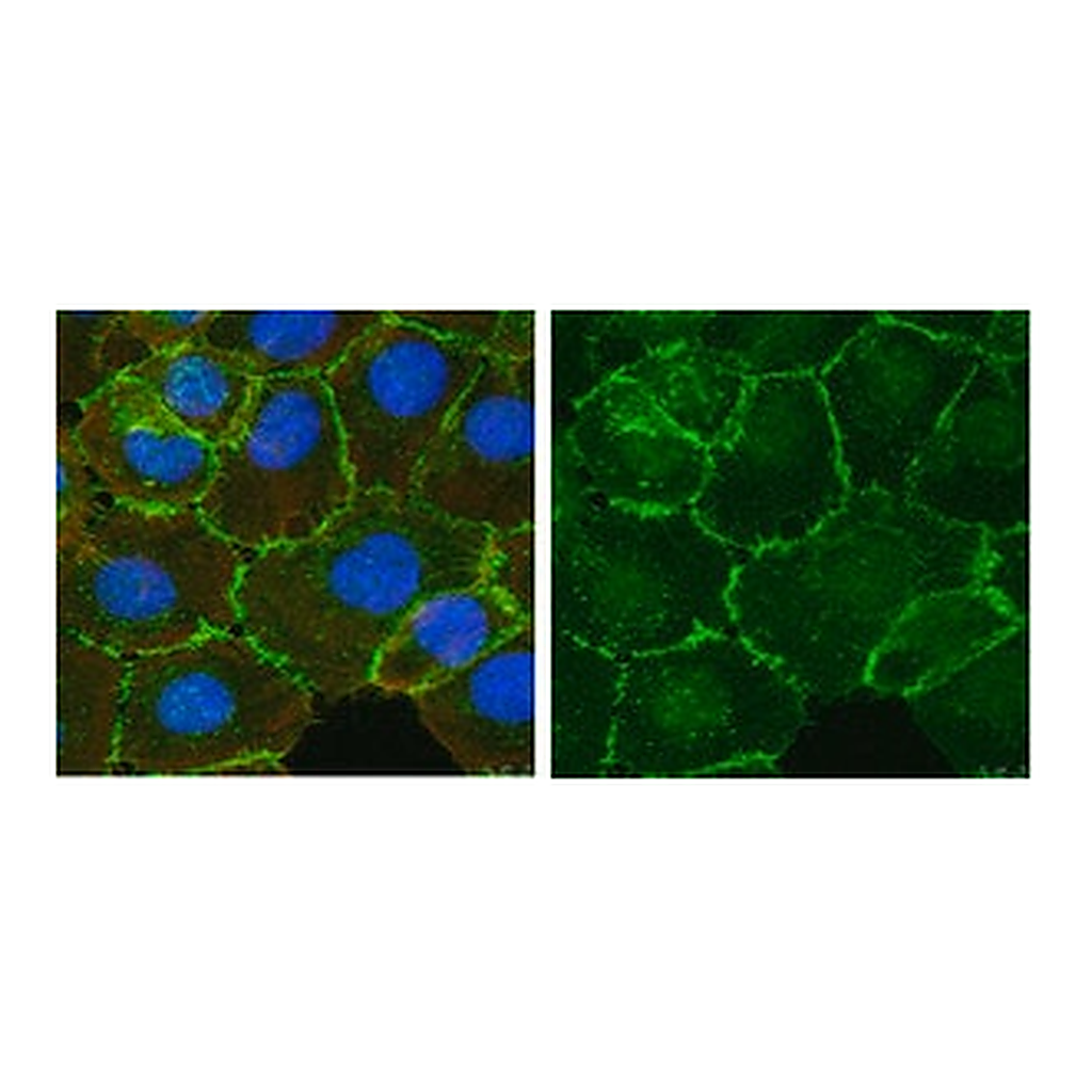 Merck Anti-β-Catenin Antibody