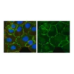 Merck Anti-β-Catenin Antibody