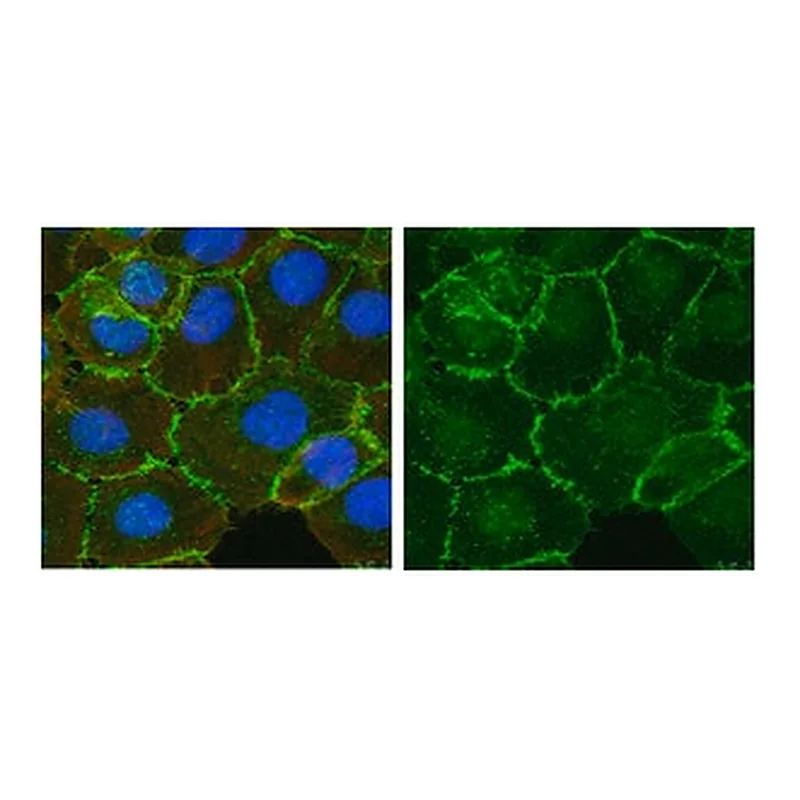 Merck Anti-β-Catenin Antibody