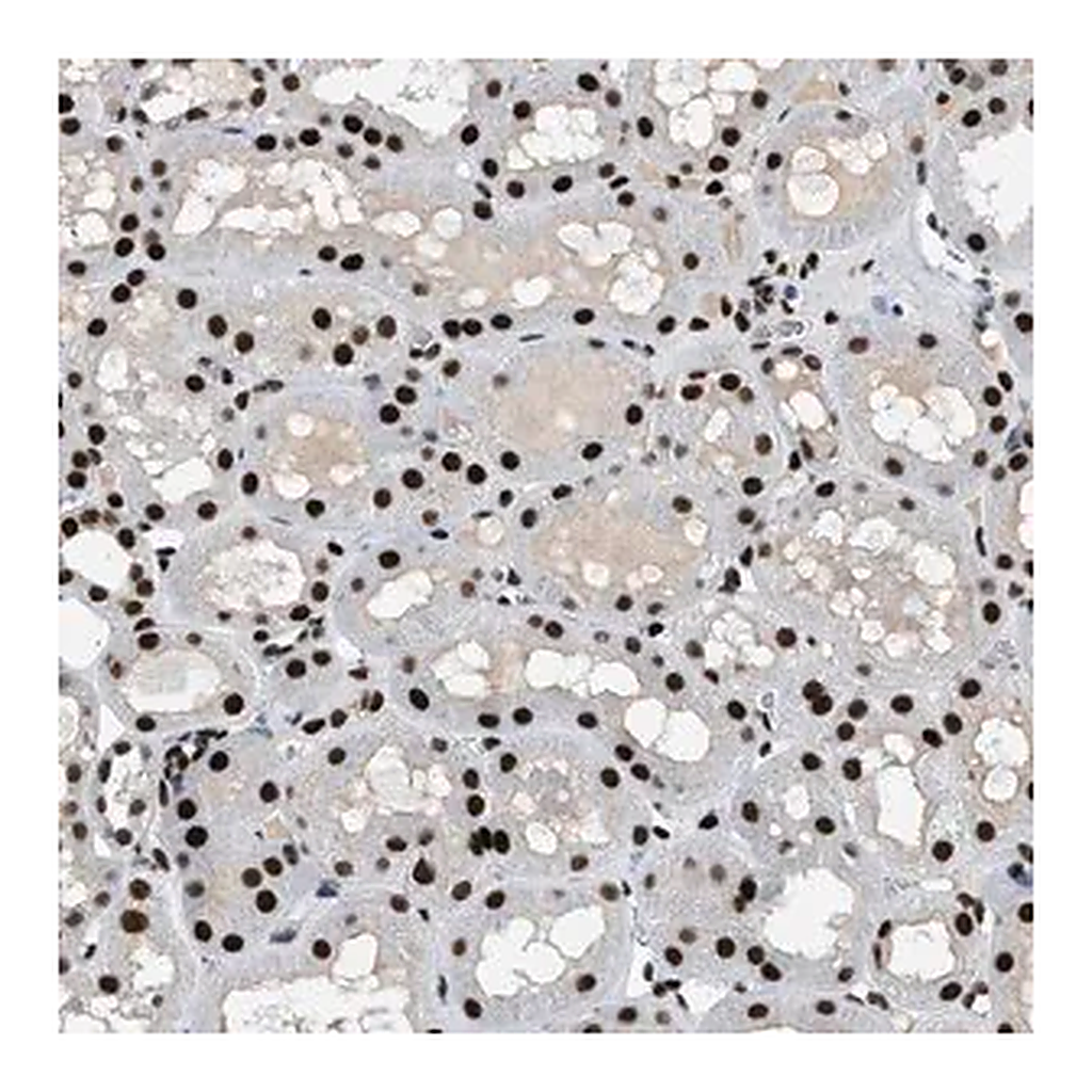 Merck Anti-ZBTB20 antibody produced in rabbit