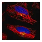 Merck Anti-ATP7A antibody produced in rabbit