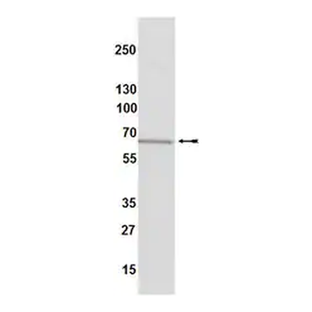 Merck Anti-Estrogen Receptor α Antibody, clone 60C, rabbit monoclonal