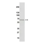 Merck Anti-Estrogen Receptor α Antibody, clone 60C, rabbit monoclonal