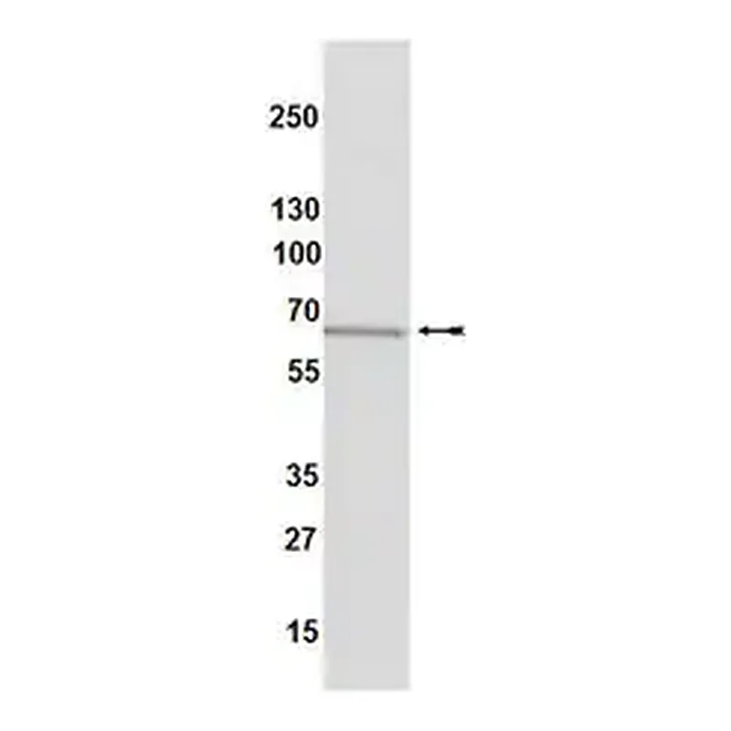 Merck Anti-Estrogen Receptor α Antibody, clone 60C, rabbit monoclonal