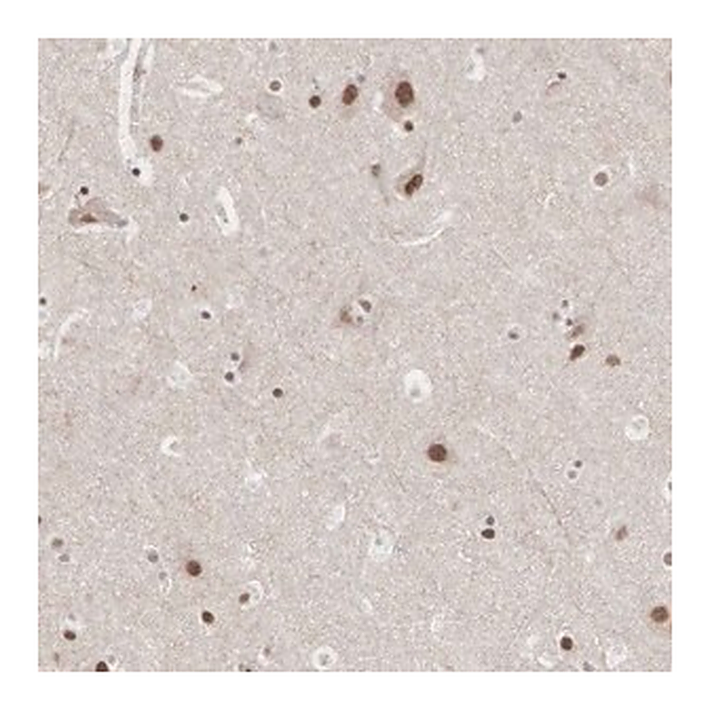 Merck Anti-AUTS2 antibody produced in rabbit