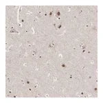 Merck Anti-AUTS2 antibody produced in rabbit