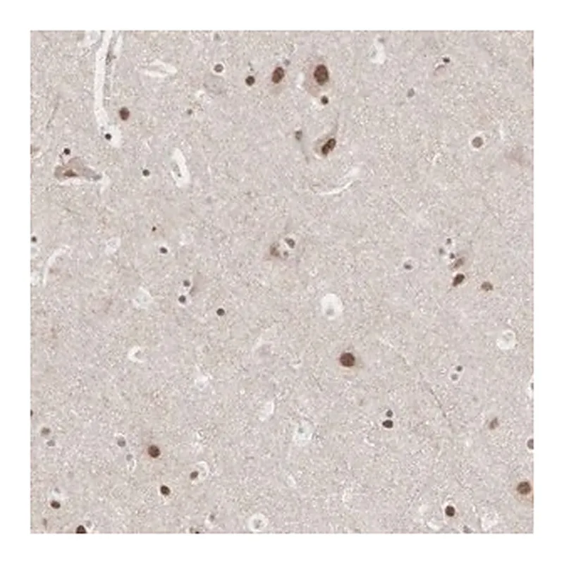 Merck Anti-AUTS2 antibody produced in rabbit