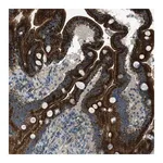 Merck Anti-FAR1 antibody produced in rabbit
