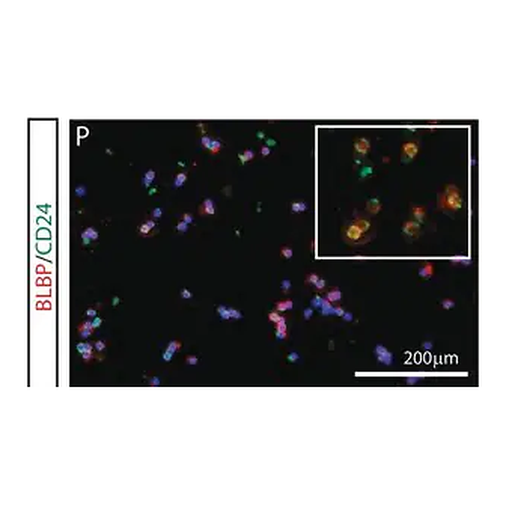 Merck Anti-Brain lipid binding protein Antibody