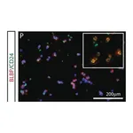 Merck Anti-Brain lipid binding protein Antibody