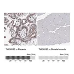 Merck Anti-TMEM165 antibody produced in rabbit
