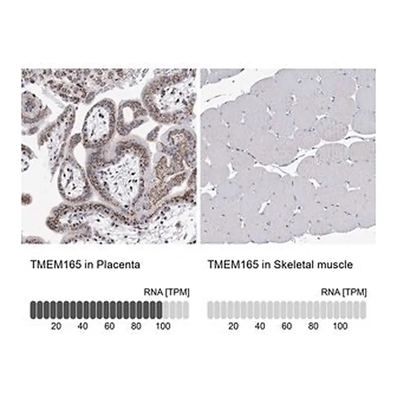 Merck Anti-TMEM165 antibody produced in rabbit