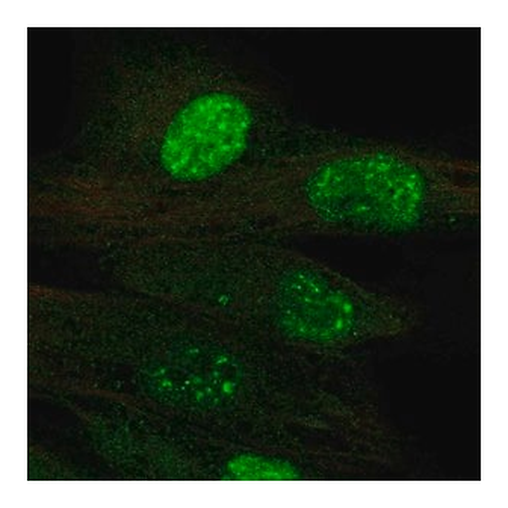Merck Anti-TERT antibody produced in rabbit