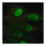 Merck Anti-TERT antibody produced in rabbit