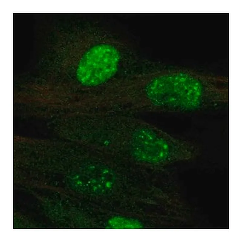 Merck Anti-TERT antibody produced in rabbit