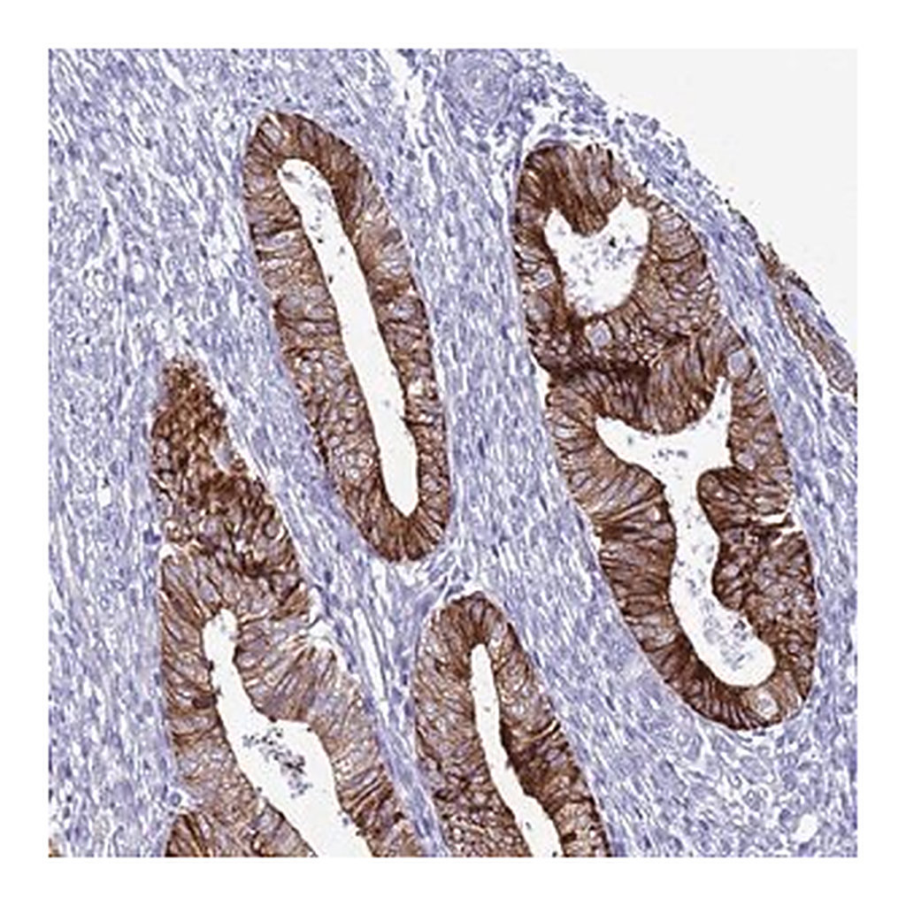 Merck Anti-ABHD17B antibody produced in rabbit
