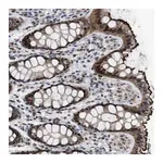 Merck Anti-SETDB1 antibody produced in rabbit