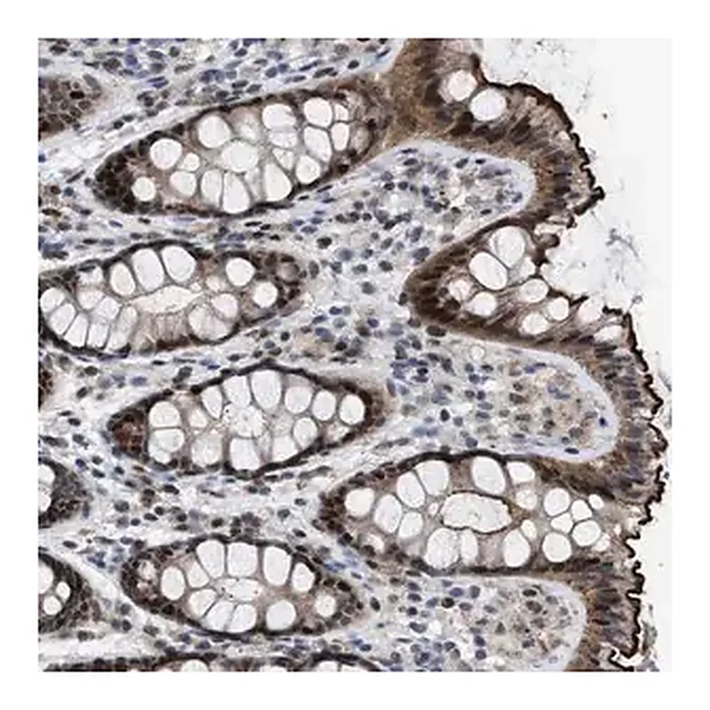 Merck Anti-SETDB1 antibody produced in rabbit