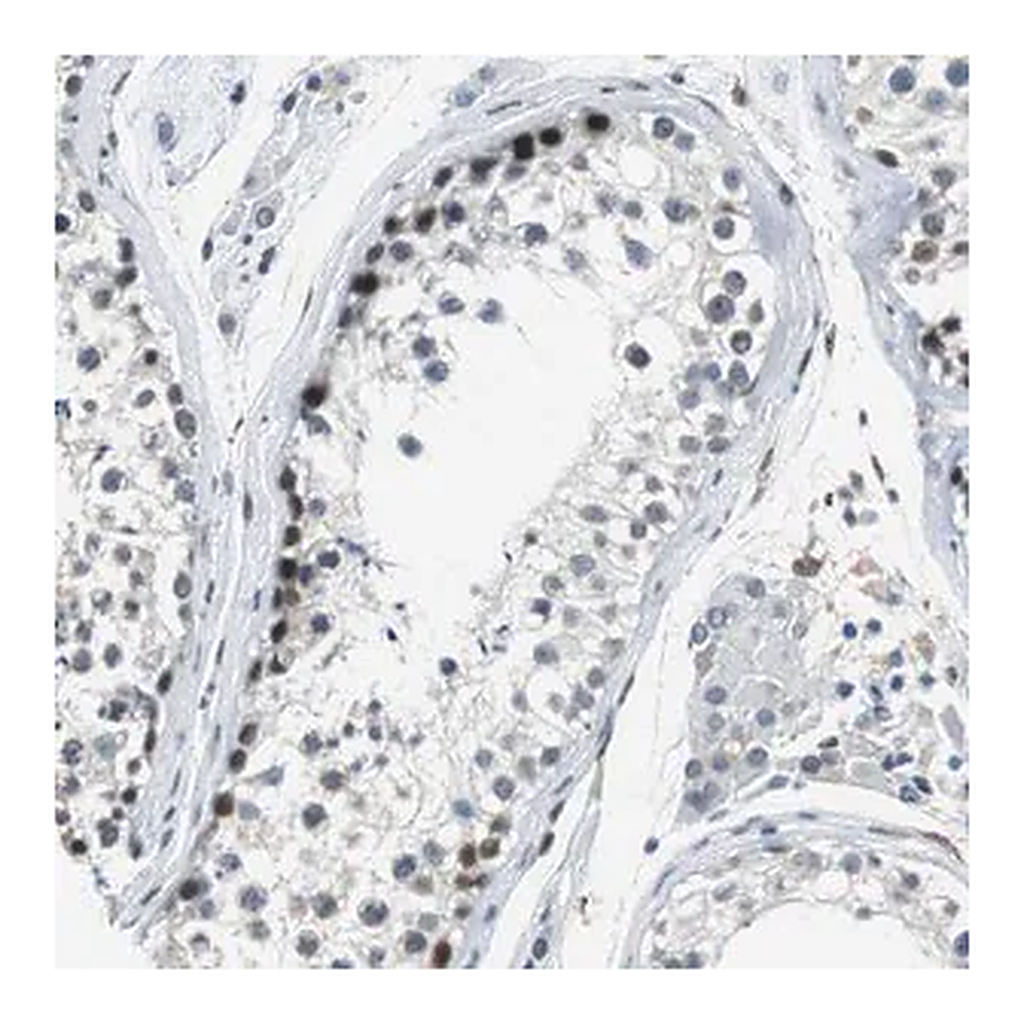 Merck Anti-ECD antibody produced in rabbit