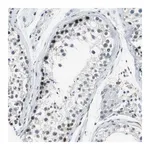 Merck Anti-ECD antibody produced in rabbit