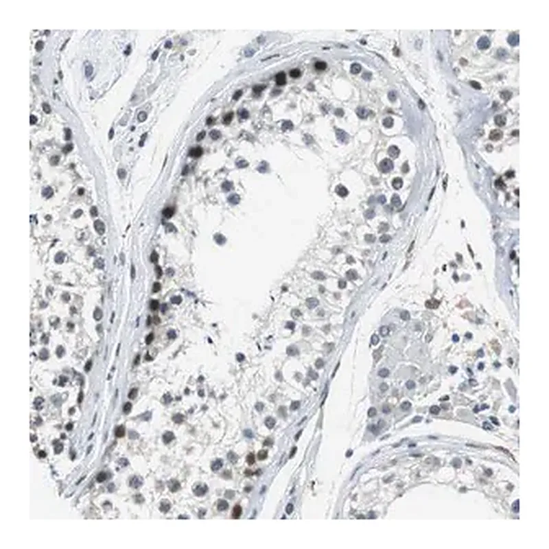 Merck Anti-ECD antibody produced in rabbit