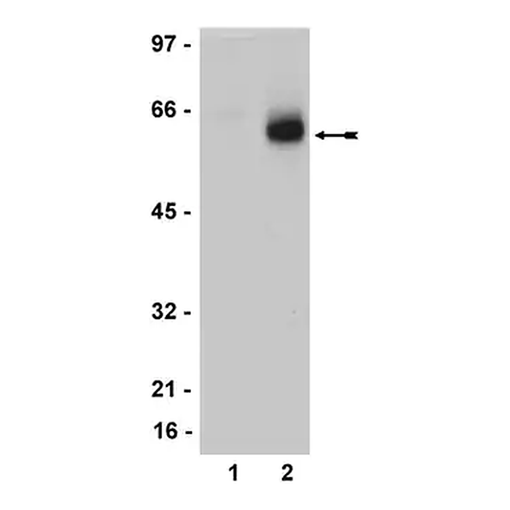Merck Anti-Estrogen Receptor β Antibody, clone 68-4, rabbit monoclonal