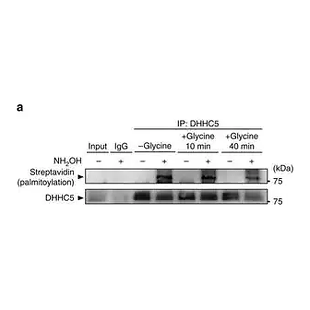 Merck Anti-ZDHHC5 antibody produced in rabbit