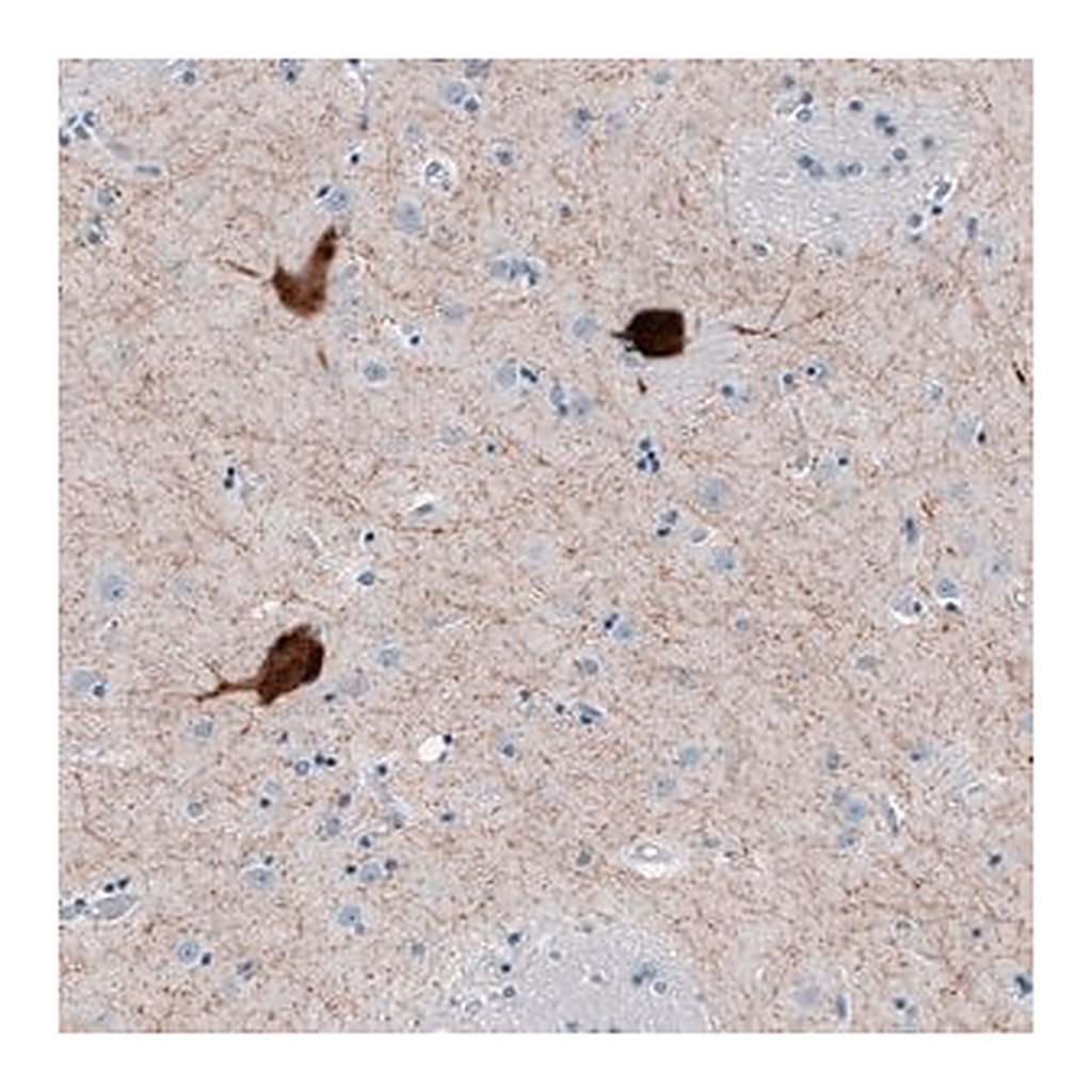 Merck Anti-CHAT antibody produced in rabbit