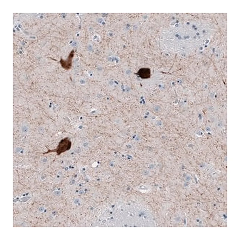 Merck Anti-CHAT antibody produced in rabbit