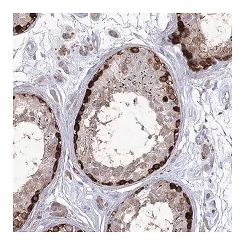 Merck Anti-STT3B antibody produced in rabbit