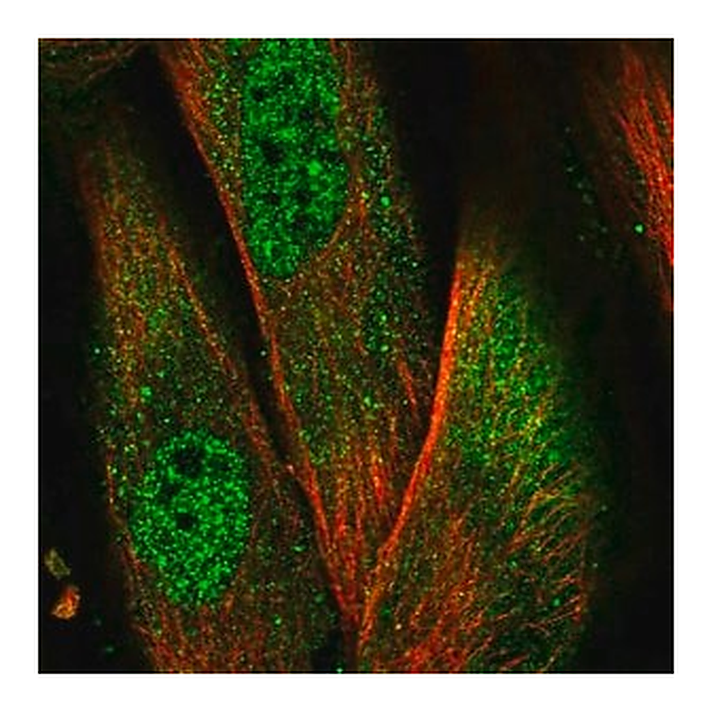 Merck Anti-NLRP1 antibody produced in rabbit