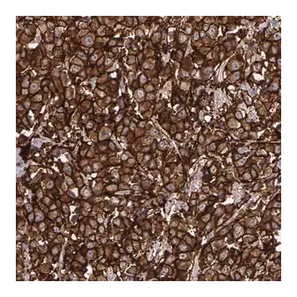 Merck Anti-ERBB2 antibody produced in rabbit