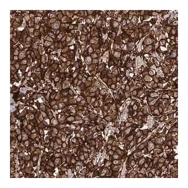 Merck Anti-ERBB2 antibody produced in rabbit