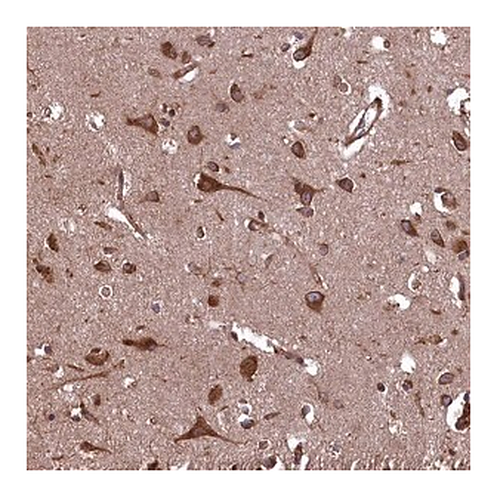 Merck Anti-PLA2G4C antibody produced in rabbit