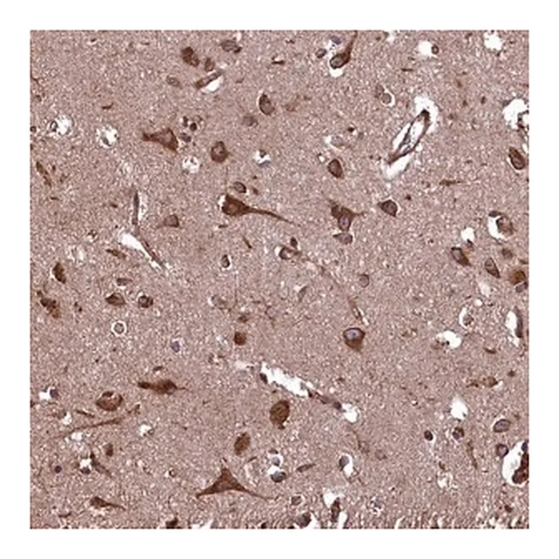 Merck Anti-PLA2G4C antibody produced in rabbit