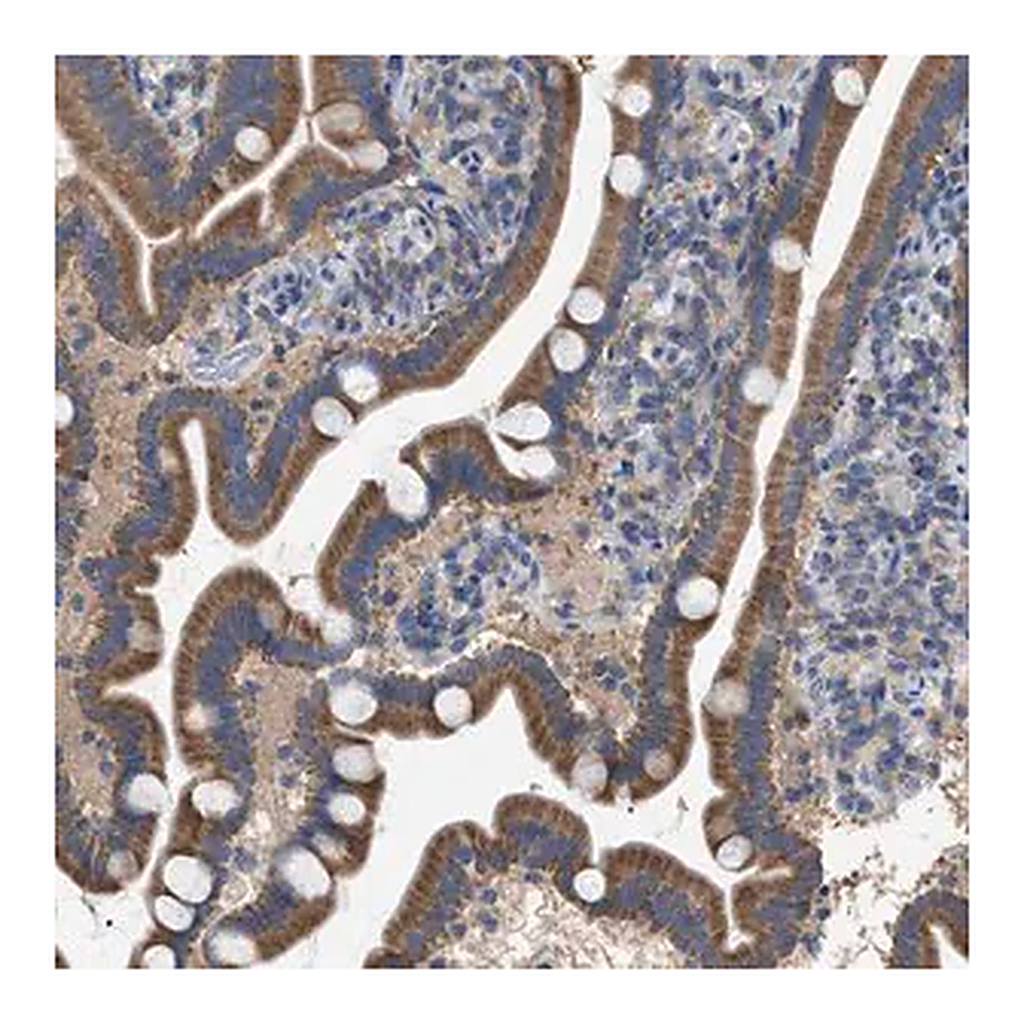 Merck Anti-VPS13A antibody produced in rabbit