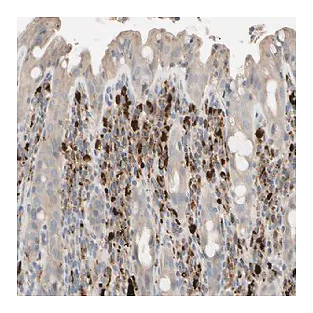 Merck Anti-CECR1 antibody produced in rabbit