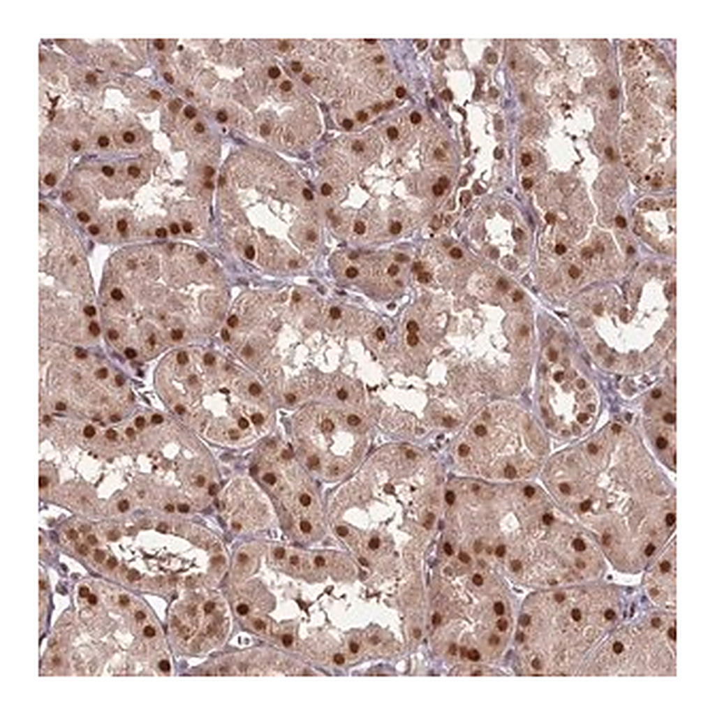 Merck Anti-CEP83 antibody produced in rabbit