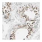 Merck Anti-MLLT10 antibody produced in rabbit