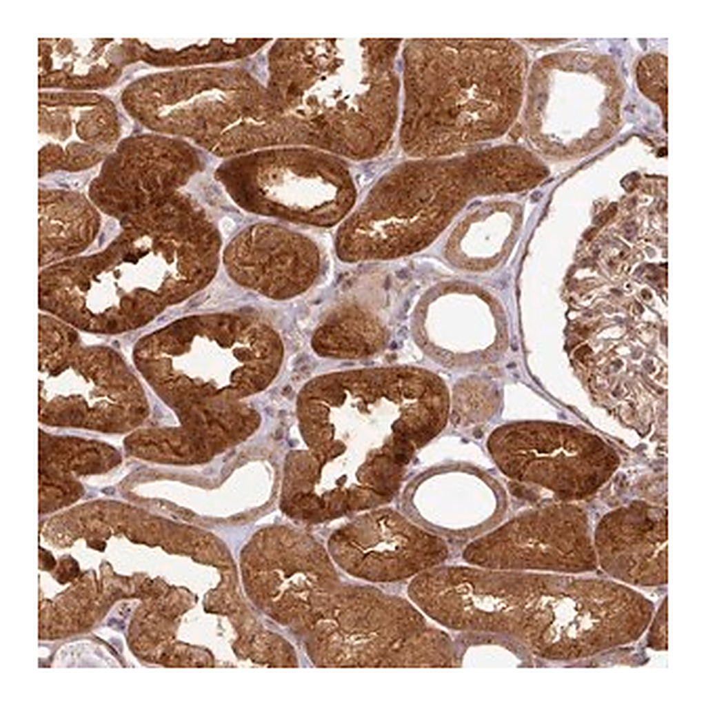 Merck Anti-ATAT1 antibody produced in rabbit