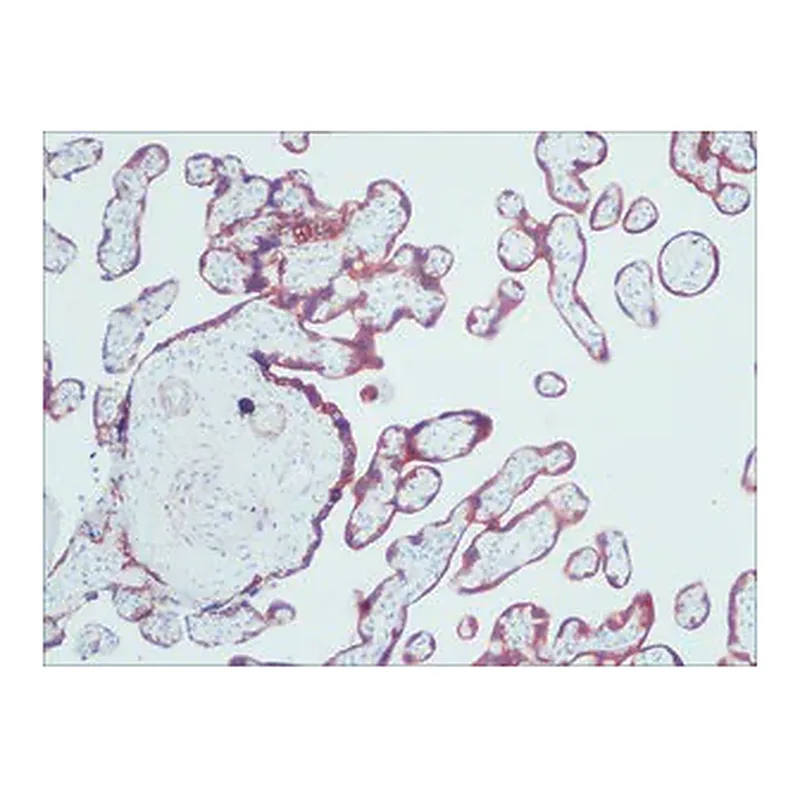 Merck Anti-Cytokeratin, pan antibody, Mouse monoclonal