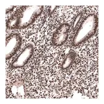 Merck Anti-SETD2 antibody produced in rabbit