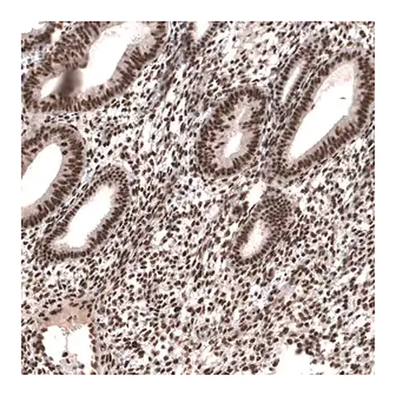 Merck Anti-SETD2 antibody produced in rabbit