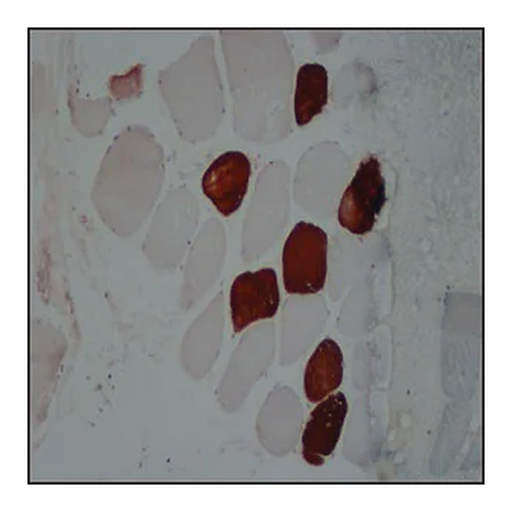 Merck Anti-Myosin (Skeletal, Slow) antibody, Mouse monoclonal