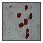 Merck Anti-Myosin (Skeletal, Slow) antibody, Mouse monoclonal