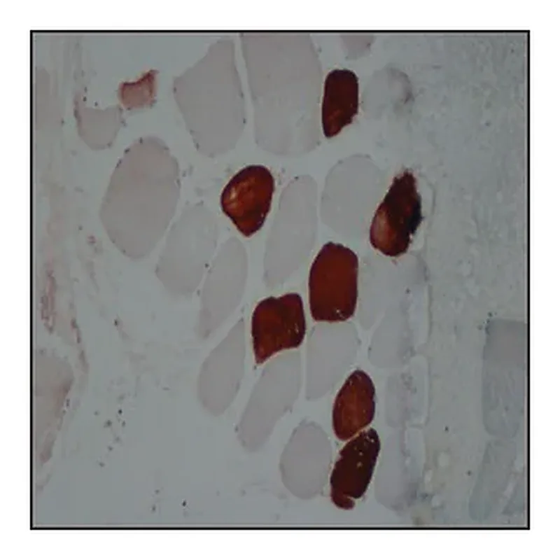 Merck Anti-Myosin (Skeletal, Slow) antibody, Mouse monoclonal