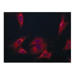 Merck Anti-Coronin-1C (C-terminal) antibody produced in rabbit